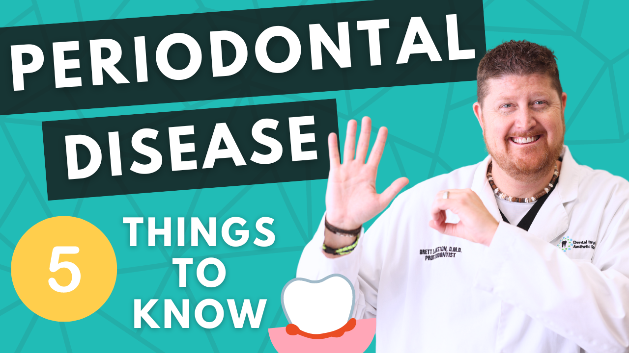 5 things to know about Periodontal disease - Featured Image