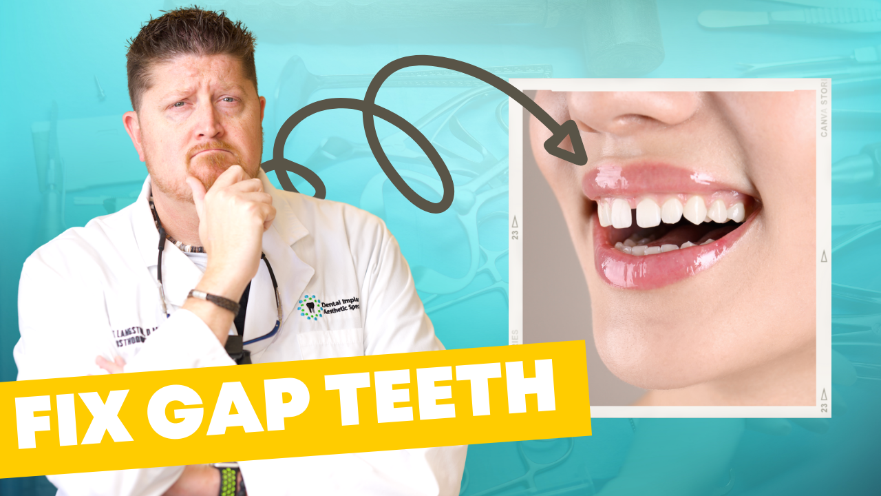 Why Do People Have GAP TEETH & The Best Ways to Fix It Graphic