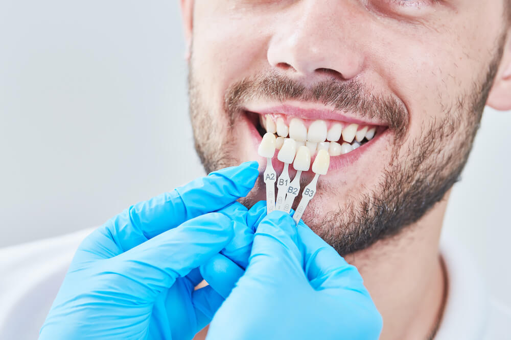 dentist in atlanta finding the right veneers in a closeup image for a man with a beard