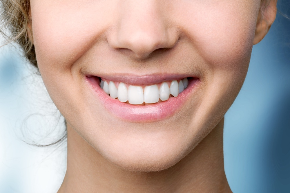 woman with perfect teeth after going to the dentist and getting crowns