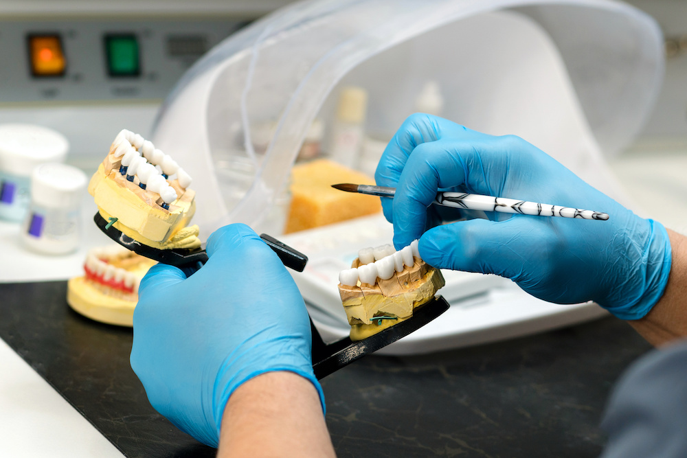 dentist finalizing implants for a new patient