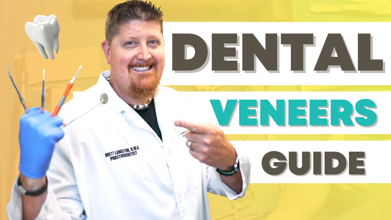 Dental Veneers Guide Graphic