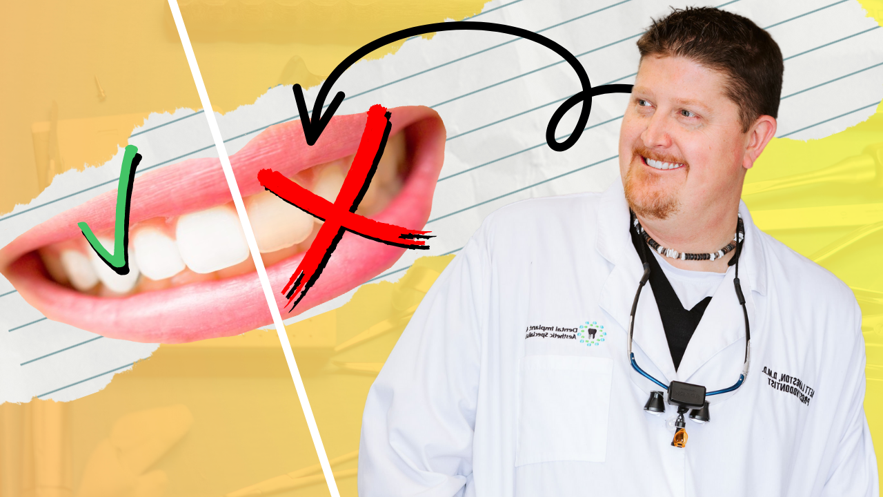 Dont Let Your Dental Veneers Turn yellow graphic banner