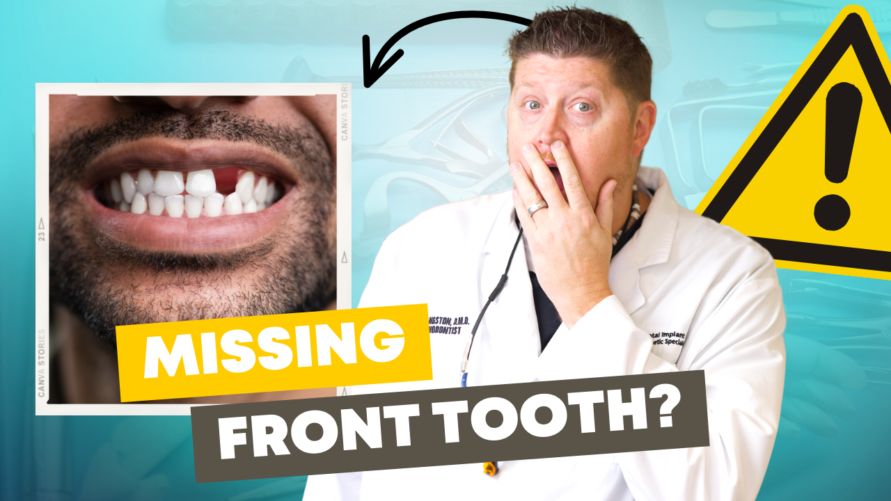 Replace a missing tooth - temporary tooth replacement you make