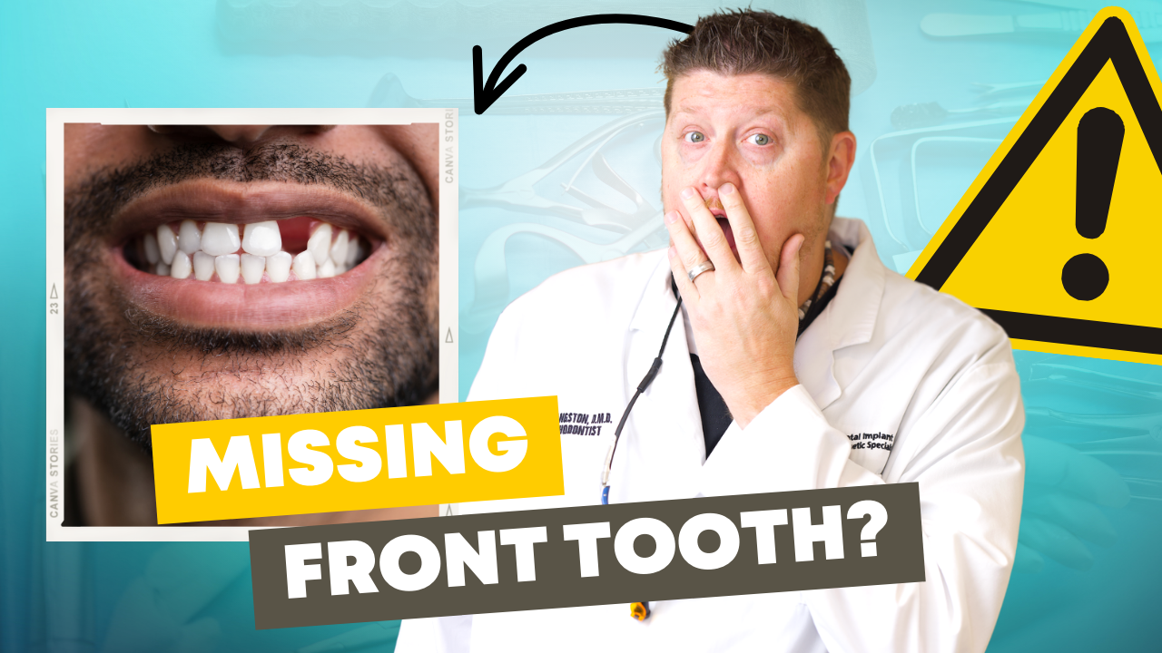 Hockey smiles: Many players opt not to replace their missing teeth