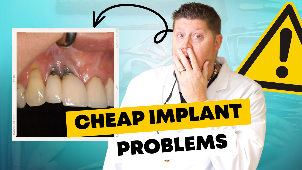 Problem with Cheap Implants