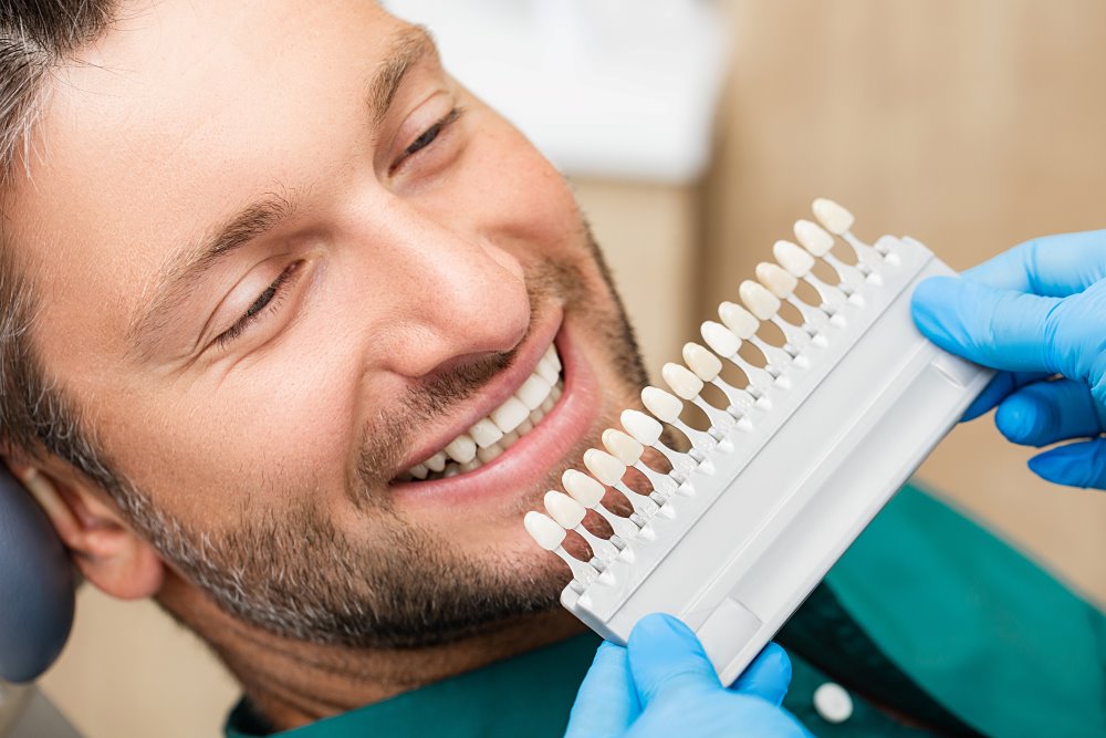 A dentist matching a male patient's veneer color to his natural teeth.